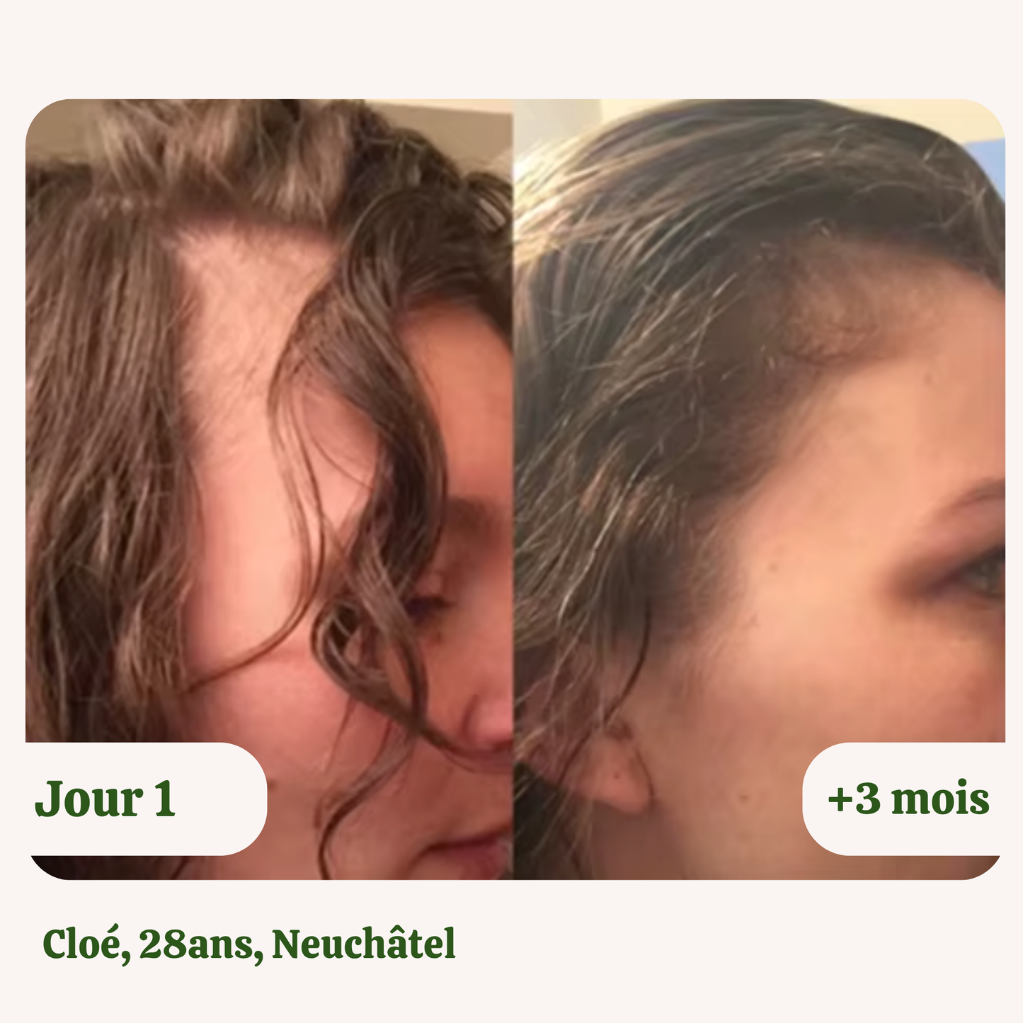 Huile de croissance naturelle pour cheveux