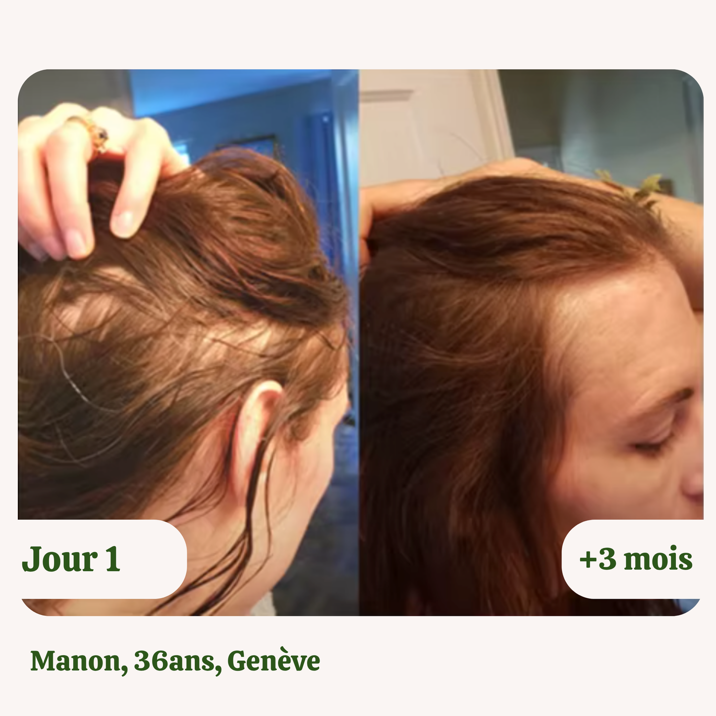 Huile de croissance naturelle pour cheveux