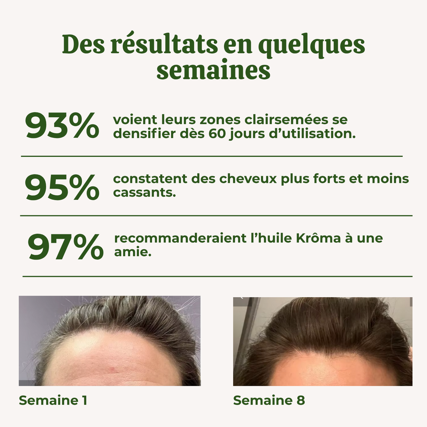 Huile de croissance naturelle pour cheveux