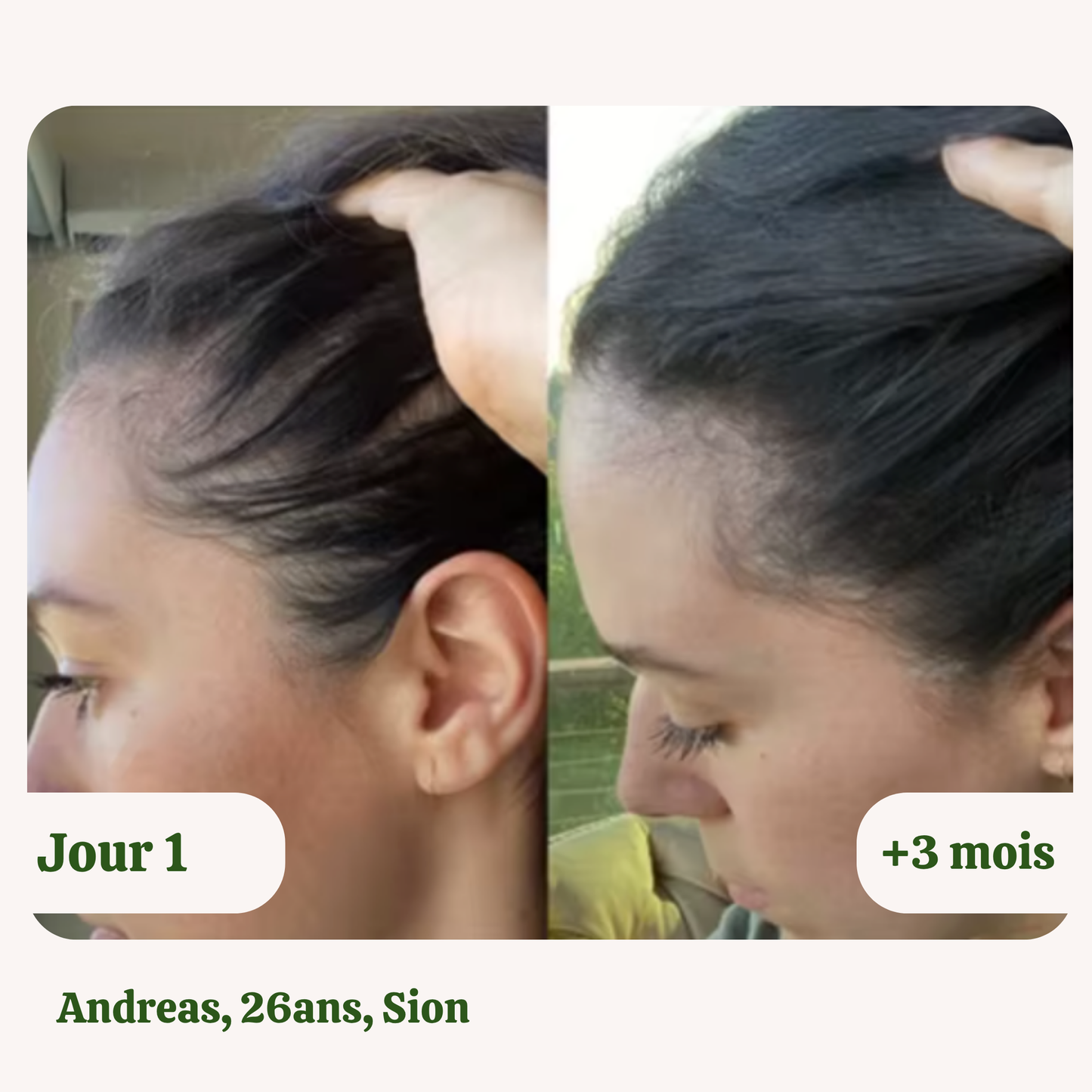 Huile de croissance naturelle pour cheveux